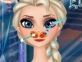                                                                     Frozen Elsa Nose Doctor ﺔﺒﻌﻟ