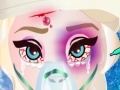                                                                     Elsa Head Injury ﺔﺒﻌﻟ