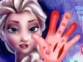                                                                     Frozen. Hand surgery ﺔﺒﻌﻟ