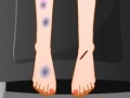                                                                     Sara Feet Accident ﺔﺒﻌﻟ