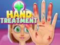                                                                     Hand Treatment ﺔﺒﻌﻟ