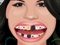                                                                     Selena Gomez Perfect Teeth  ﺔﺒﻌﻟ